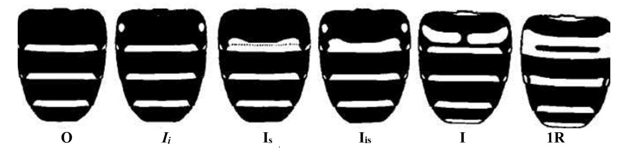 Рис. 1.
- Морфотипы трутней (по Ф.&nbsp;Руттнеру, 2006): О – темный; Ii&nbsp;–
маленькие «островки»; Is–широкая седловидная полоса; Iis– маленькие «островки» и широкая седловидная полоса; I – большие островки; 1R – 1 кольцо